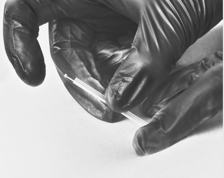 Physical therapy charleston dry needling mount pleasant sports rehab